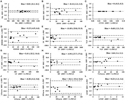 Relationship Between Heart Rate Variability and Pulse Rate Variability Measures in Patients After Coronary Artery Bypass Graft Surgery